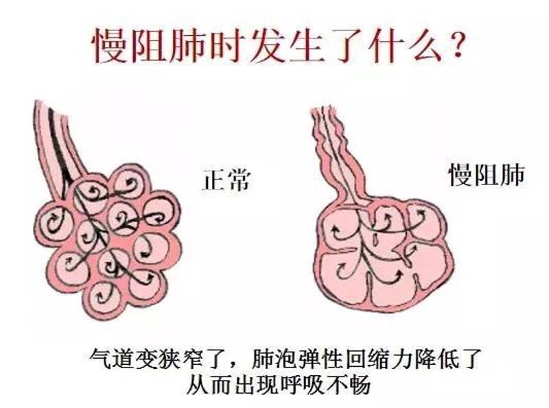 探访济南哮喘病医院:呼吸健康的守护神