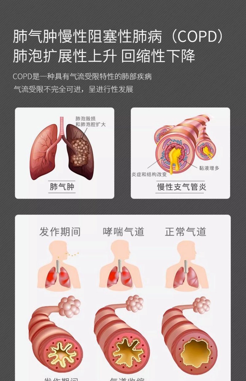 济南哮喘治疗现状与展望:一场呼吸的较量